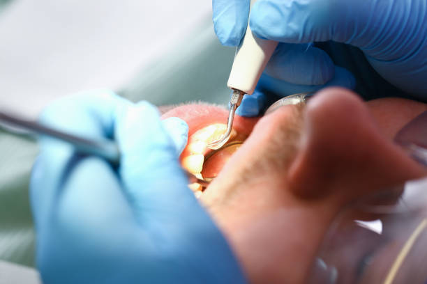 Best Holiday Emergency Dentist in Harpersville, AL