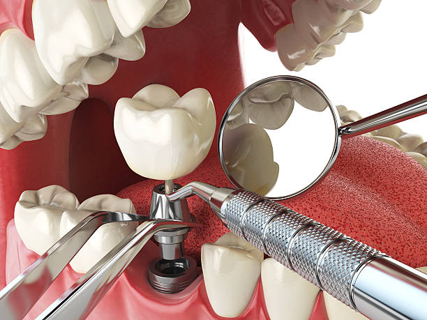 Best Urgent Dental Care for Toothache in Harpersville, AL
